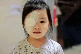 Does My Child Have A “Lazy Eye”?